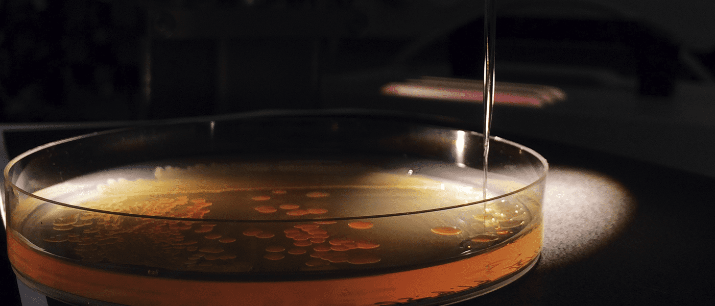 Biofilm – O2 and N2O microprofiles in samples from CF patients